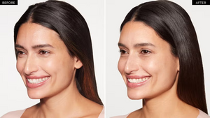 ¡Dinos la verdad! ¿Qué te hiciste? Descubre el tratamiento que da un glow irresistible