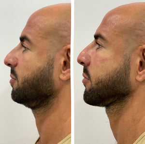 4 mitos sobre los tratamientos faciales estéticos para hombres