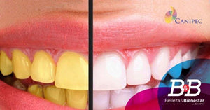 6 Razones por las que tus dientes se ponen amarillos